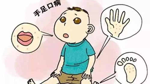 止咳化痰最快的方法,这些有效手段你必须知道 止咳化痰最快的方法,这些有效手段你必须知道